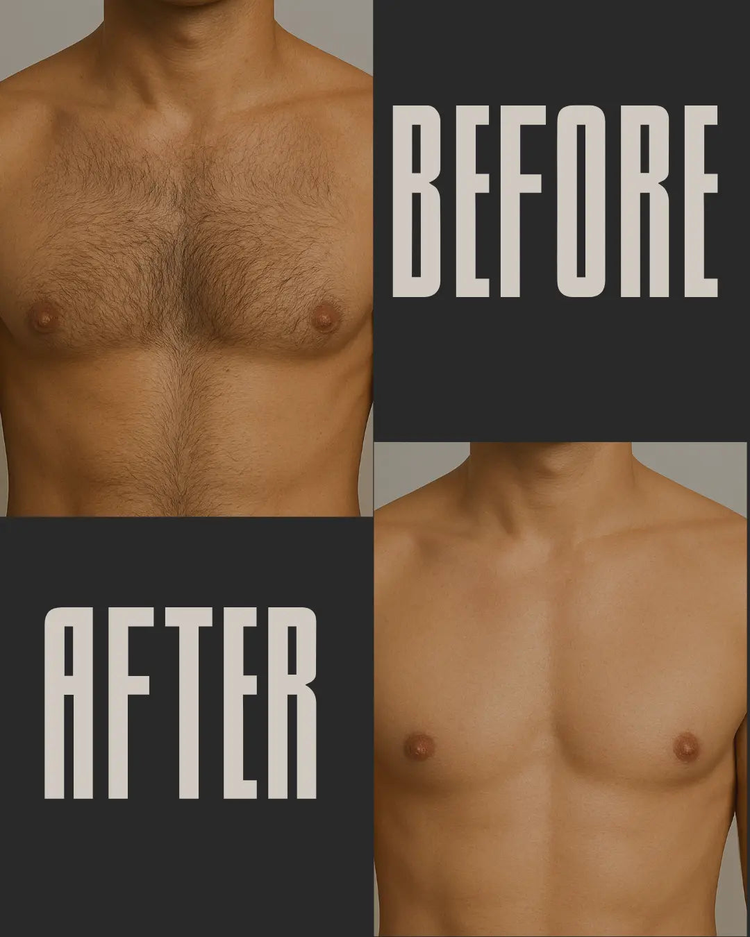 Before and after comparison of a person's chest hair on a plain background.